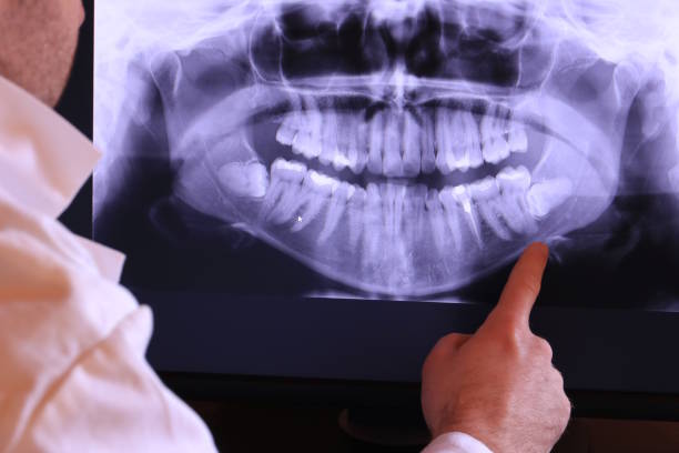Best Broken or Cracked Tooth Emergency Dentist in Six Mile, SC